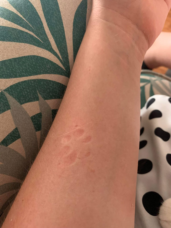 cat paw mark on arm